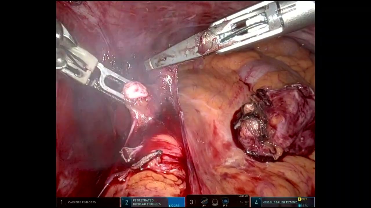 robo-sigmoid
