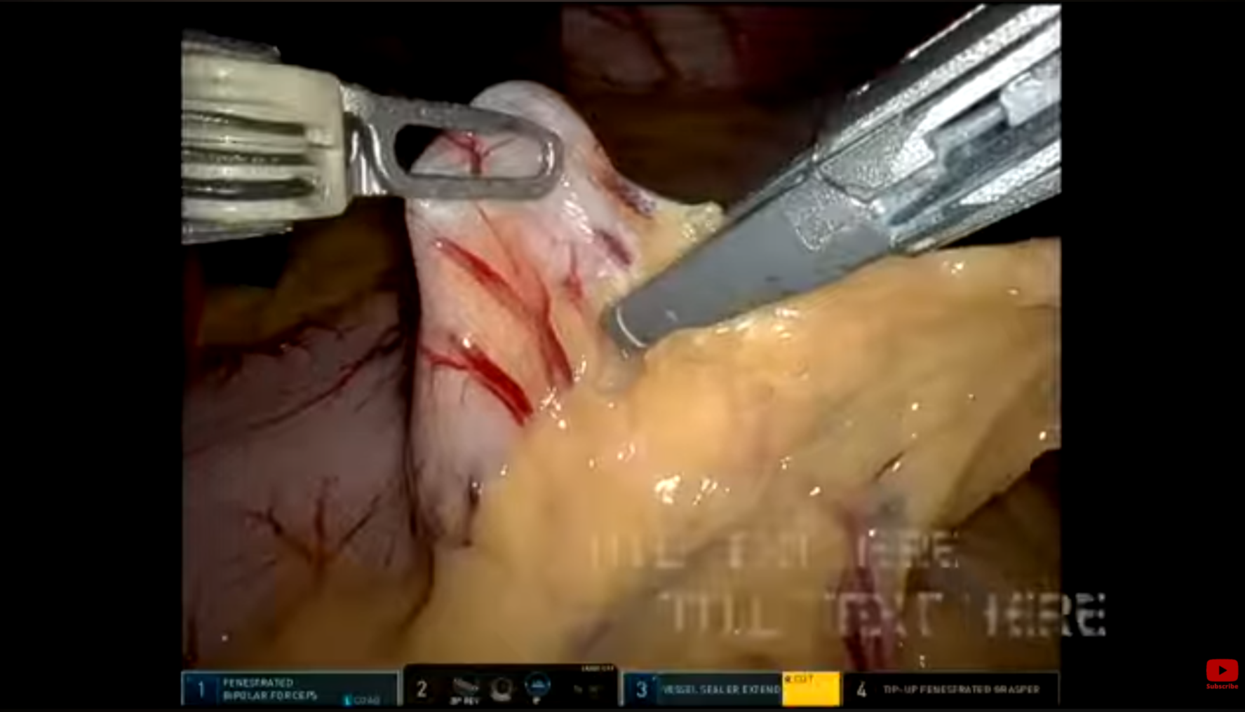 robo-sleeve